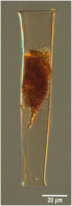 Eutintinnus perminutus (Kofoid &amp; Campbell 1929)