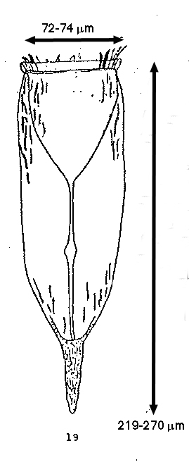 Favella quequenense Balech, 1945