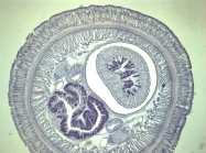 Transverse section (holotype)