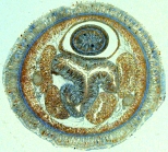 Transverse section of monostiliferous nemertean