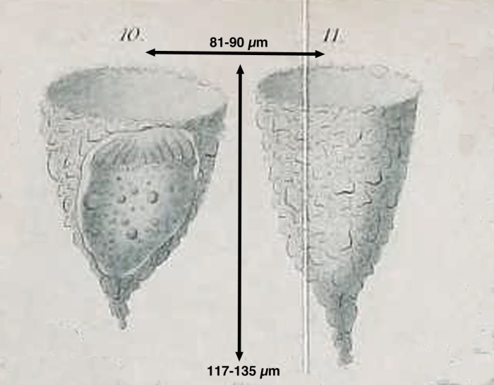 Tintinnopsis vosmaeri Daday, 1887
