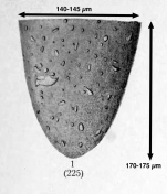 Tintinnopsis sacculus var. magna