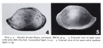 Lectotype of Bairdia hirsuta Brady, 1880 (from Puri & Hulings, 1976, PI. 4, figs 4, 5)