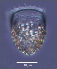 Acanthostomella minutissima Kofoid & Campbell, 1929