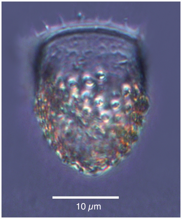 Acanthostomella minutissima Kofoid &amp; Campbell, 1929