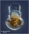 Amplectella monocollaria (Laackmann, 1910) Kofoid & Campbell 1929