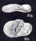 Ophthalmina (?) pulvula McCulloch, 1981