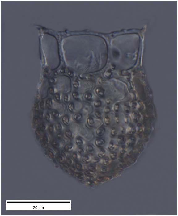 Dictyocysta extensa Kofoid &amp; Campbell, 1929