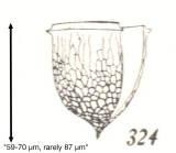 Epiplocylis brandti Kofoid & Campbell, 1929