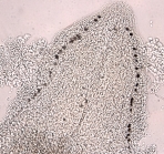 Cephalotrichella cf. alba (head under cover glass)