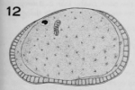 Xestoleberis punctata Tressler, 1949 from the original description