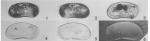 Anchistrocheles mcquadei Maddocks, 1976 from the original description