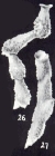 Calcituba (?) trinidadensis McCulloch, 1981