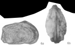 Quadracythere brachypygaia Bold, 1965 from the original description