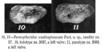 Paracytheridea washingtonensis Puri, 1954