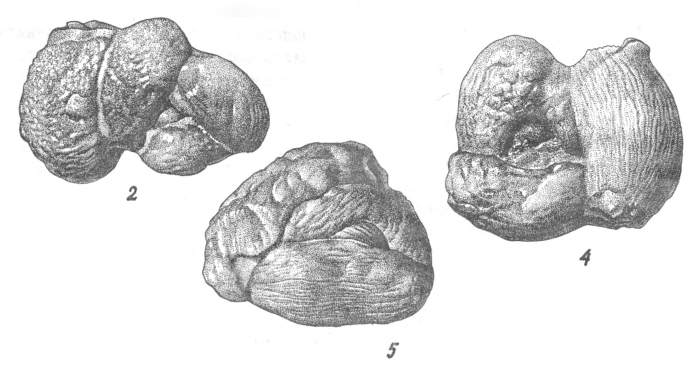 Quinqueloculina voloshinovae f. abnormis Bogdanovich, 1971 Quinqueloculina voloshinovae f. abnormis Bogdanovich, 1971