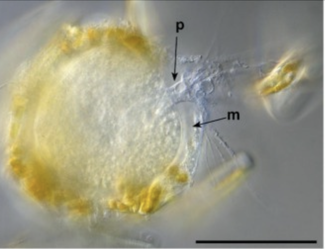 Pensilisphaera antarcticaensis Solbach, Siemensma &amp; Holzmann, 2025