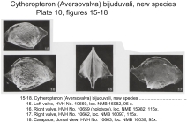 Cytheropteron (Aversovalva) bijuduvali Bold, 1988 from the original description
