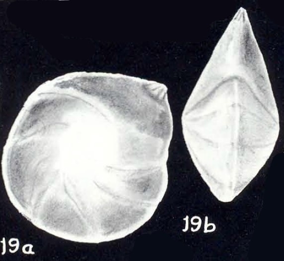 "Robulus" orbiculariformis McCulloch, 1981