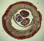 Holotype