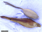 Utricle and nutlet of Carex archeri from specimen NSW 19532 (Australia