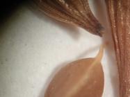 Close-up of surface of achene of holotype P00466041