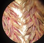 Perigynia of Carex mannii