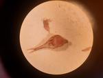 Achene of Carex sphaerogyna