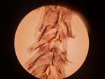 Closeup of perigynia of lectotype