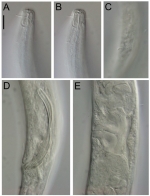 Sabatieria pararticulata