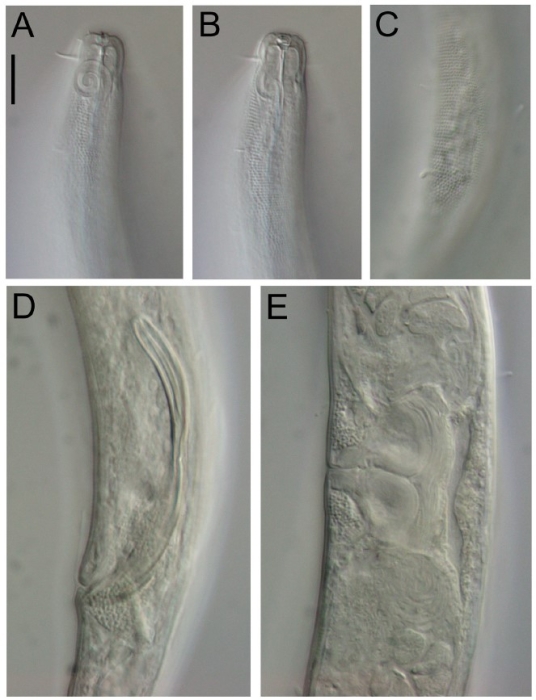 Sabatieria pararticulata Sabatieria pararticulata