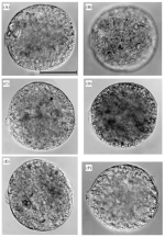 Bathyallogromia weddellensis Gooday, Holzmann, Guiard, Cornelius & Pawlowski, 2004