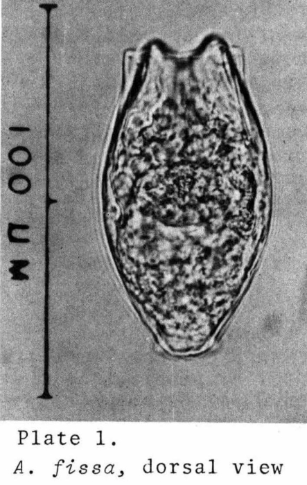 Anuraeopsis fissa Anuraeopsis fissa