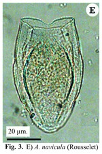 Anuraeopsis navicula