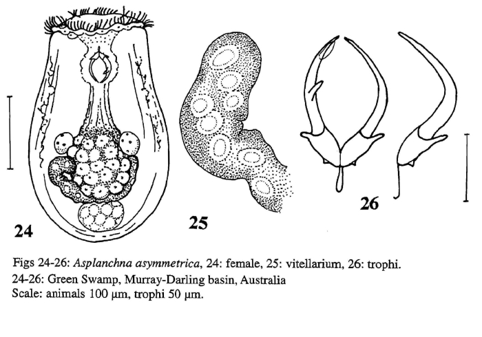 Asplanchna asymmetrica