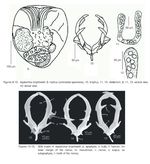 Asplanchna brightwellii