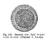 Asplanchna brightwellii
