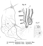 Asplanchna brightwellii