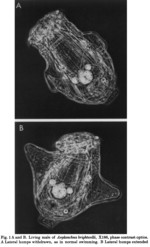 Asplanchna brightwellii