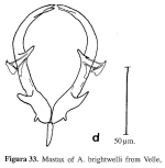 Asplanchna brightwellii