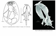 Asplanchna priodonta