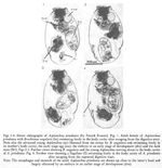 Asplanchna priodonta