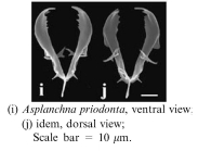 Asplanchna priodonta
