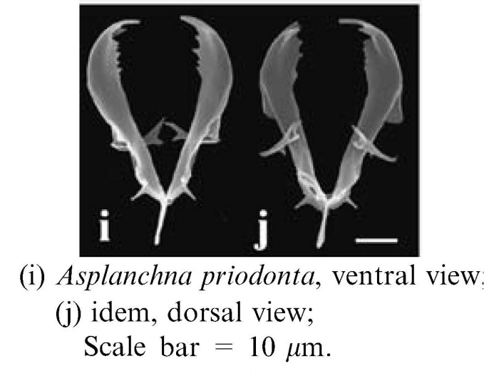 Asplanchna priodonta Asplanchna priodonta