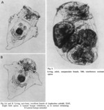 Asplanchna sieboldii