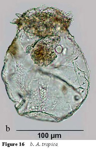 Asplanchna tropica