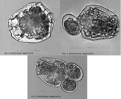 Brachionus angularis