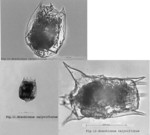 Brachionus calyciflorus