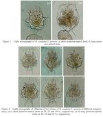 Brachionus caudatus f. apsteini