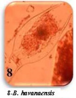 Brachionus diversicornis